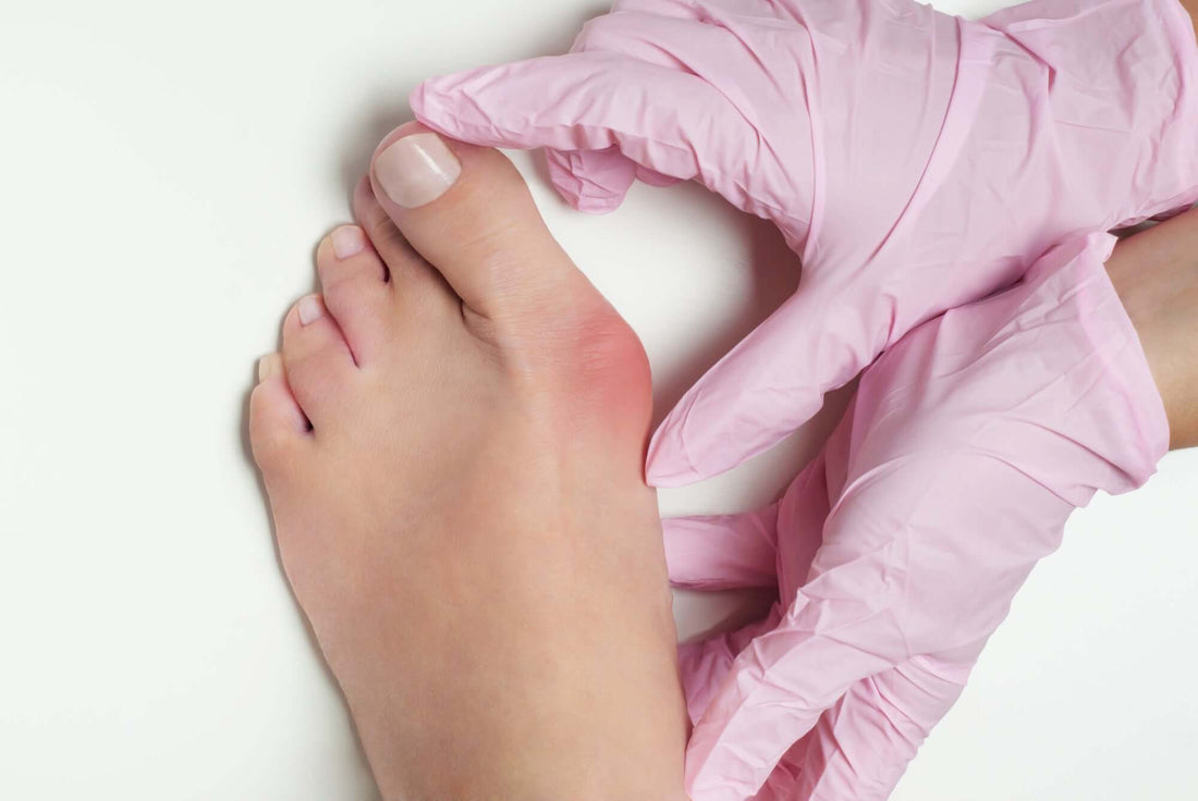 how-to-prevent-bunions.png