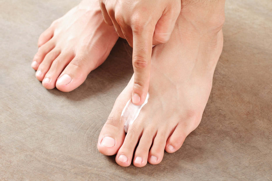 athlete's-foot-treatments.png